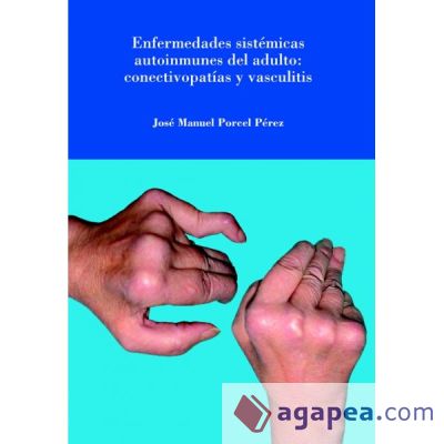 Enfermedades sistémicas autoinmunes del adulto: conectivopatías y vasculitis. (Ebook)