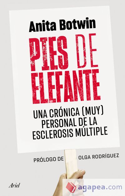 Pies de elefante