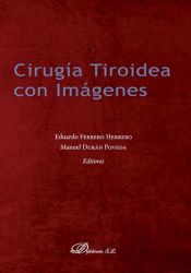 Portada de Cirugía Tiroidea con imágenes