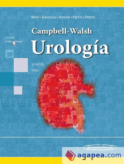 Campbell-Wash, Urología. Tomo 2