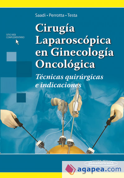 Cirugía Laparoscópica en Ginecología Oncológica