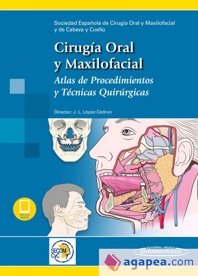 Cirugía Oral y Maxilofacial: Atlas de procedimientos y técnicas quirúrgicas