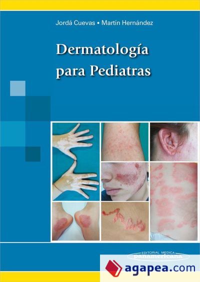 Dermatología para pediatras