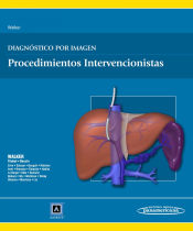 Portada de Diagnóstico por imagen. Procedimientos intervencionistas