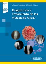 Portada de Diagnóstico y Tratamiento de las Metástasis Óseas (incluye versión digital)