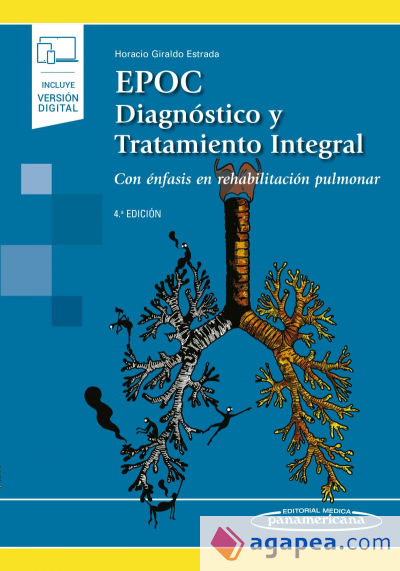 EPOC. Diagnóstico y Tratamiento Integral (incluye versión digital)