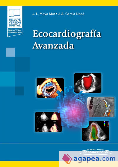 Ecocardiografía Avanzada + e-book