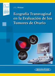 Portada de Ecografía Transvaginal en la Evaluación de los Tumores de Ovario (incluye versión digital)