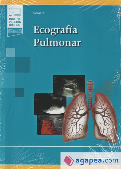 Ecografía pulmonar