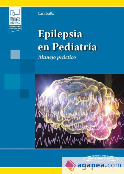 Epilepsia en Pediatría + e-book: Manejo práctico