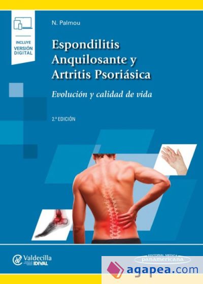 Espondilitis Anquilosantes y Artritis Psriásica+versión digital