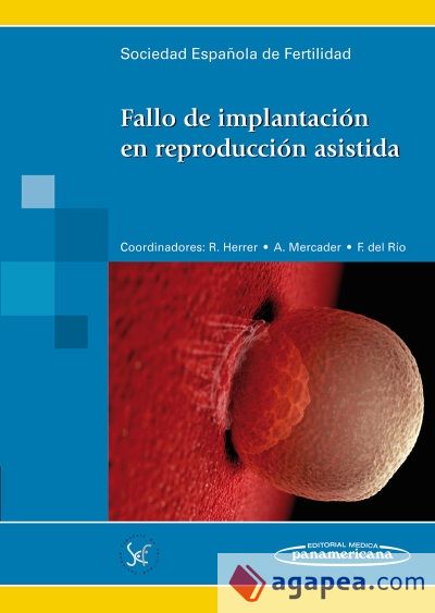 Fallo de implantación en reproducción asistida