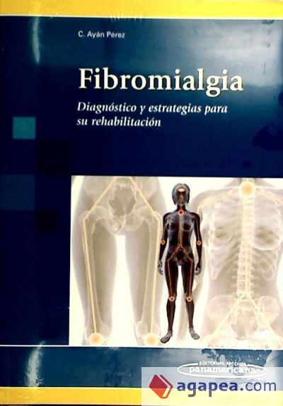 Fibromialgia