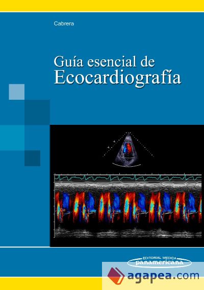 Guía esencial de Ecocardigrafía