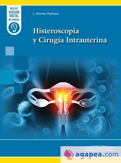 Histeroscopia y Cirugía Intrauterina