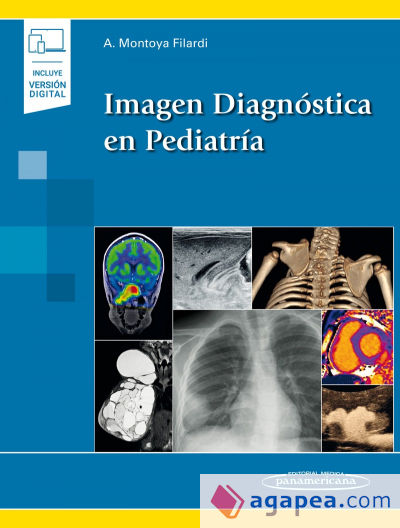 Imagen Diagnóstica en Pediatría (incluye versión digital)