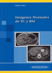 Portada de Imágenes Normales de TC y RM