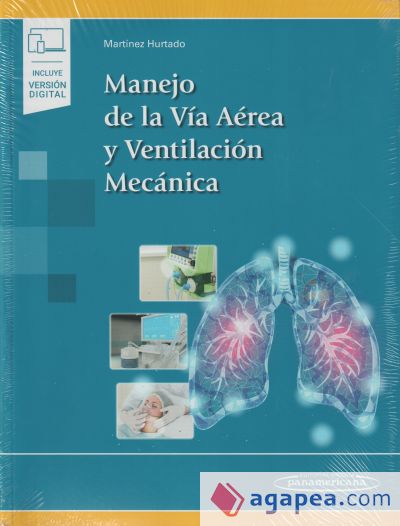 Manejo de la vía aérea y ventilación mecánica