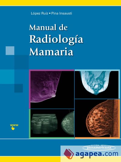 Manual de Radiología Mamaria