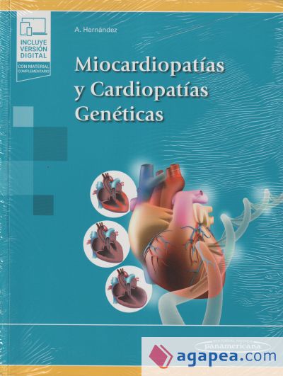 Miocardiopatías y Cardiopatías Genéticas: Miocardiopatías y Cardiopatías Genéticas