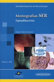 Portada de Monografía SER: Espondiloartritis