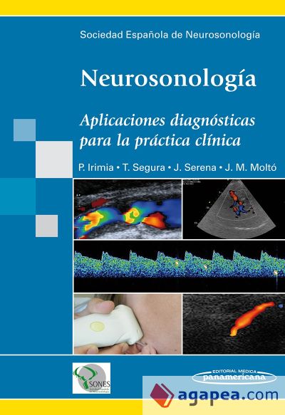 Neurosonología