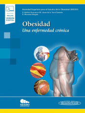 Portada de Obesidad (+ e-book): Una enfermedad crónica