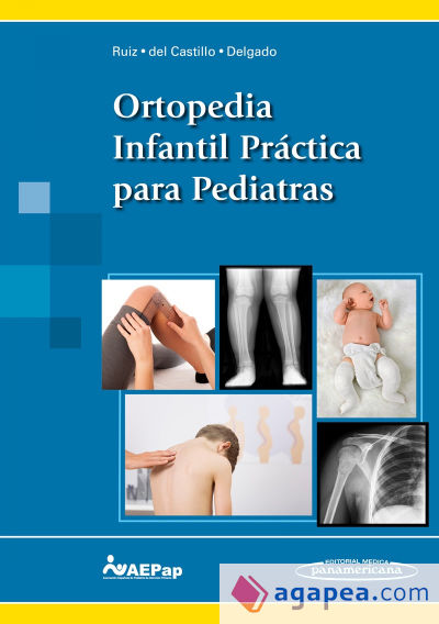 Ortopedia Infantil Práctica para Pediatras