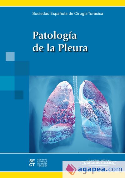 Patología de la Pleura