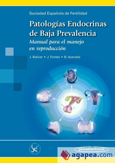 Patologías endocrinas de baja prevalencia