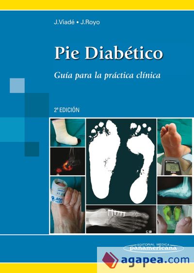 Pie Diabético