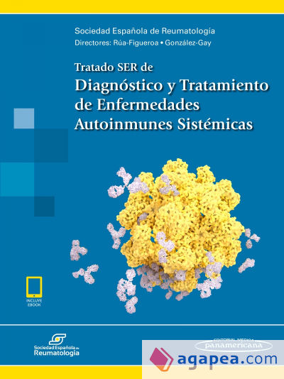 Tratado SER de Diagnóstico y Tratamiento de Enfermedades Autoinmunes Sistémicas (Incluye acceso a eBook)