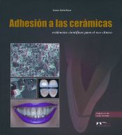 Portada de Adhesión a las cerámicas