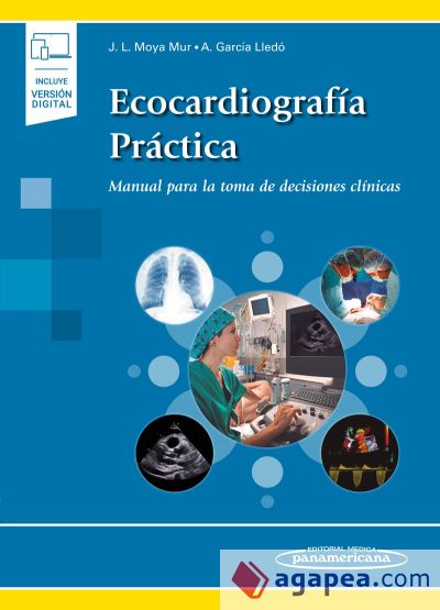 Ecocardiografía práctica