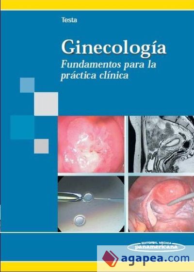Ginecología. Fundamentos para la práctica clínica