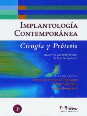 Portada de Implantología Contemporánea. Cirugía y Prótesis