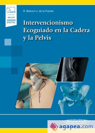 Intervencionismo Ecoguiado en la cadera y la pelvis