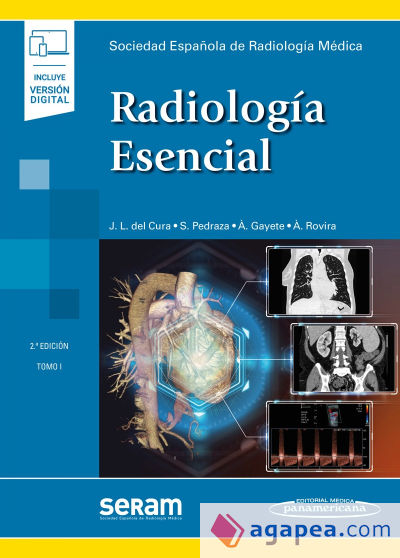 Radiología Esencial (incluye eBook)