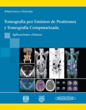 Portada de Tomografía por Emisión de Positrones y Tomografía Computarizada