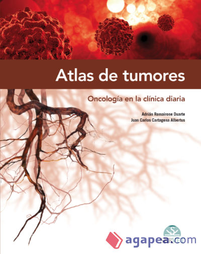 Atlas de tumores. Oncología en la clínica diaria