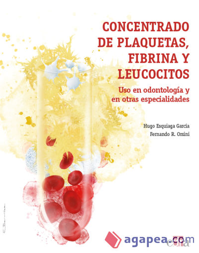 Concentrado de plaquetas, fibrina y leucocitos. Uso en odontología y en otras especialidades