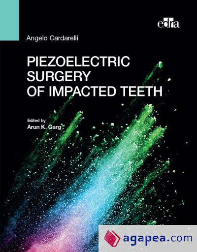 Piezoelectric surgery of impacted teeth