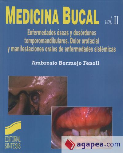 Medicina bucal. Vol. II