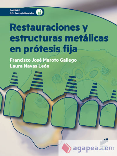 Restauraciones y estructuras metálicas en prótesis fija