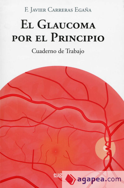 El glaucoma por el principio