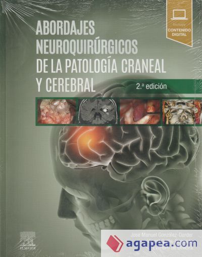 Abordajes Neuroquirurgicos Patologia Craneal Y Cerebral