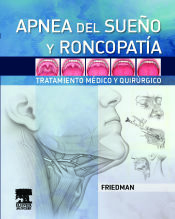 Portada de Apnea del sueño y roncopatía