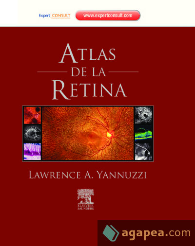 Atlas de la retina + ExpertConsult