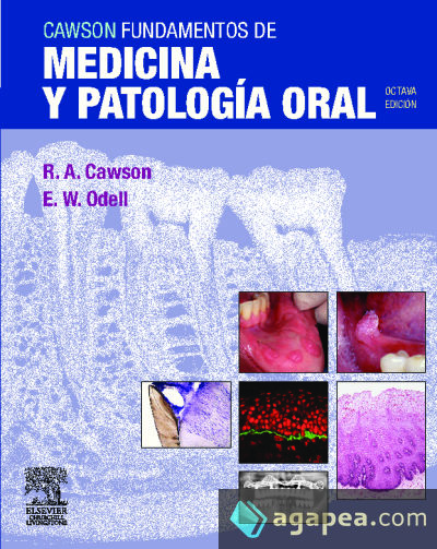 Cawson. Fundamentos de medicina y patología oral