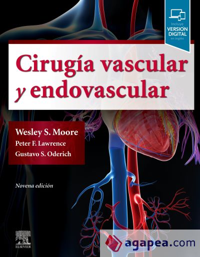 Cirugía vascular y endovascular